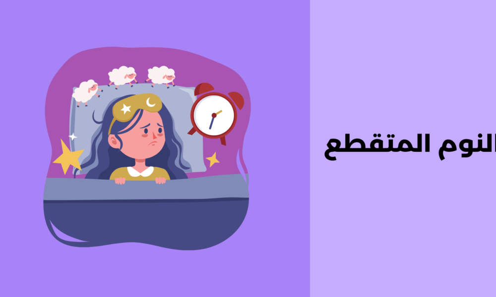 النوم المتقطع